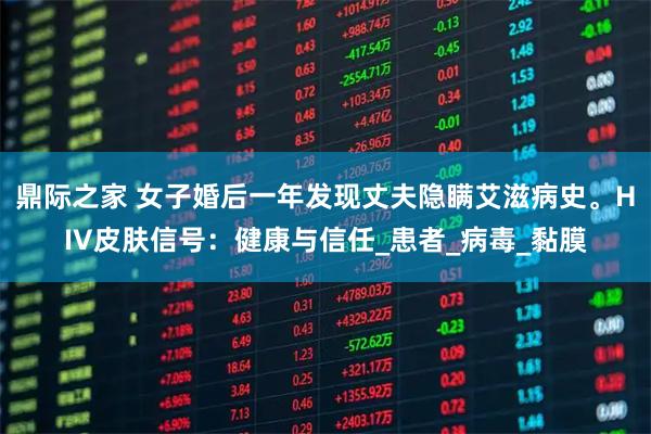 鼎际之家 女子婚后一年发现丈夫隐瞒艾滋病史。HIV皮肤信号：健康与信任_患者_病毒_黏膜